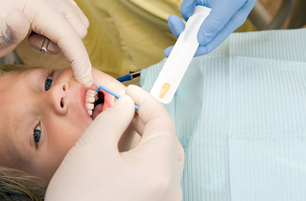 Young boy receiving fluoride treatment at Singing River Dentistry