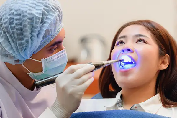 A dentist performing a dental bonding procedure using a curing light on a patient sitting in a dental chair.